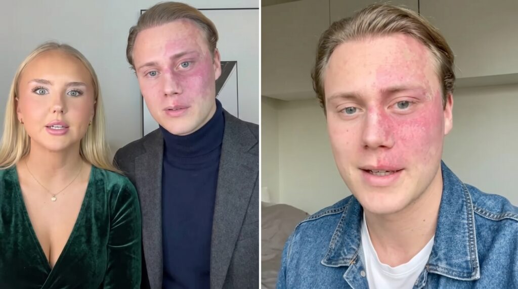 Tilda Törnqvist: ålder, pojkvän och Paradise Hotel 1 tilda tornqvist pojkvan